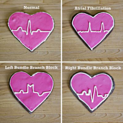 Study EKGs with a Sweet Tooth