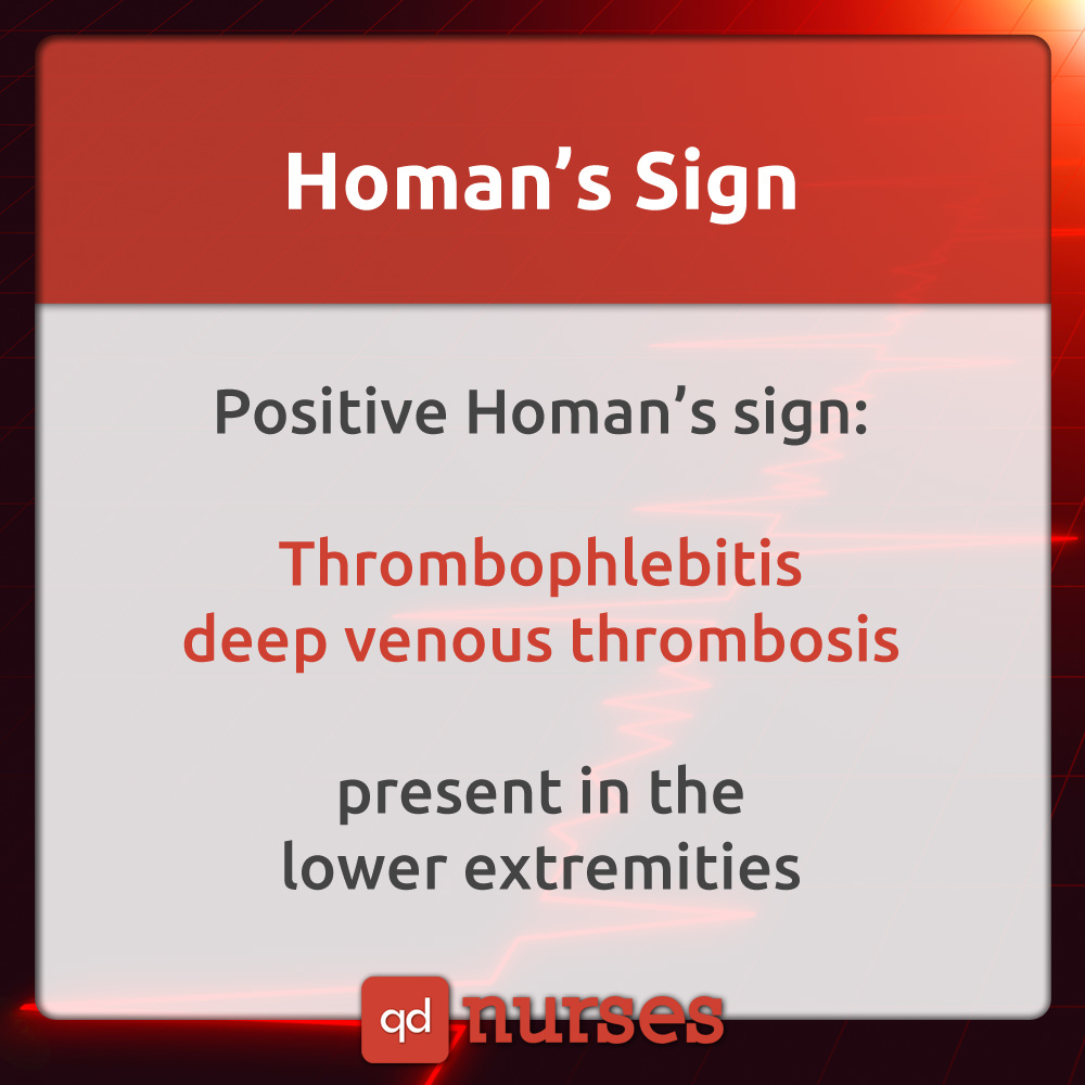 Homan's Sign