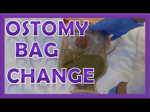 How to Change an Ostomy Pouching System