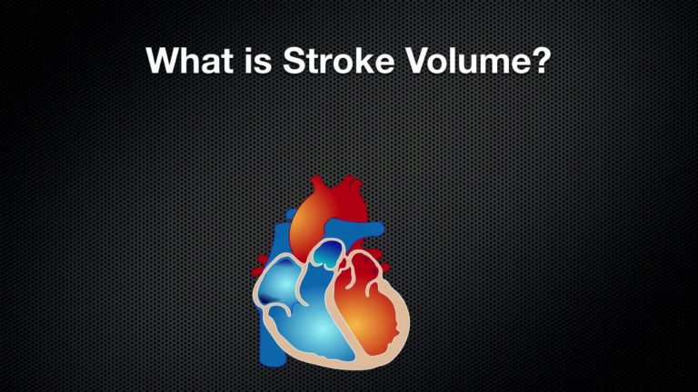 Useful Guideline to Calculating Stroke Volume