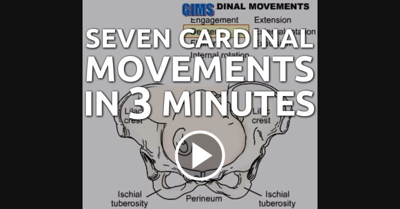 Mnemonic cardinal movements labor - verefiber
