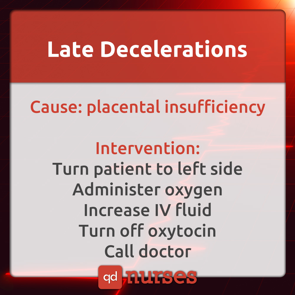 Late Decelerations