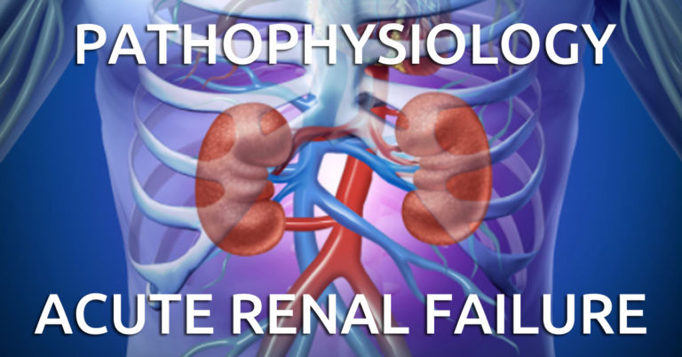 Pathophysiology of Acute Renal Failure