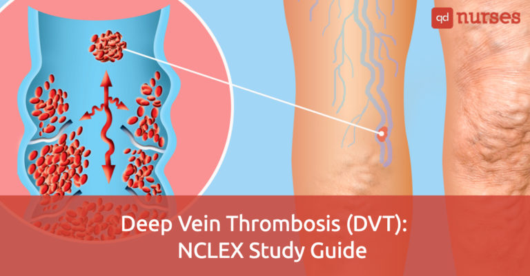 Deep Vein Thrombosis (DVT)